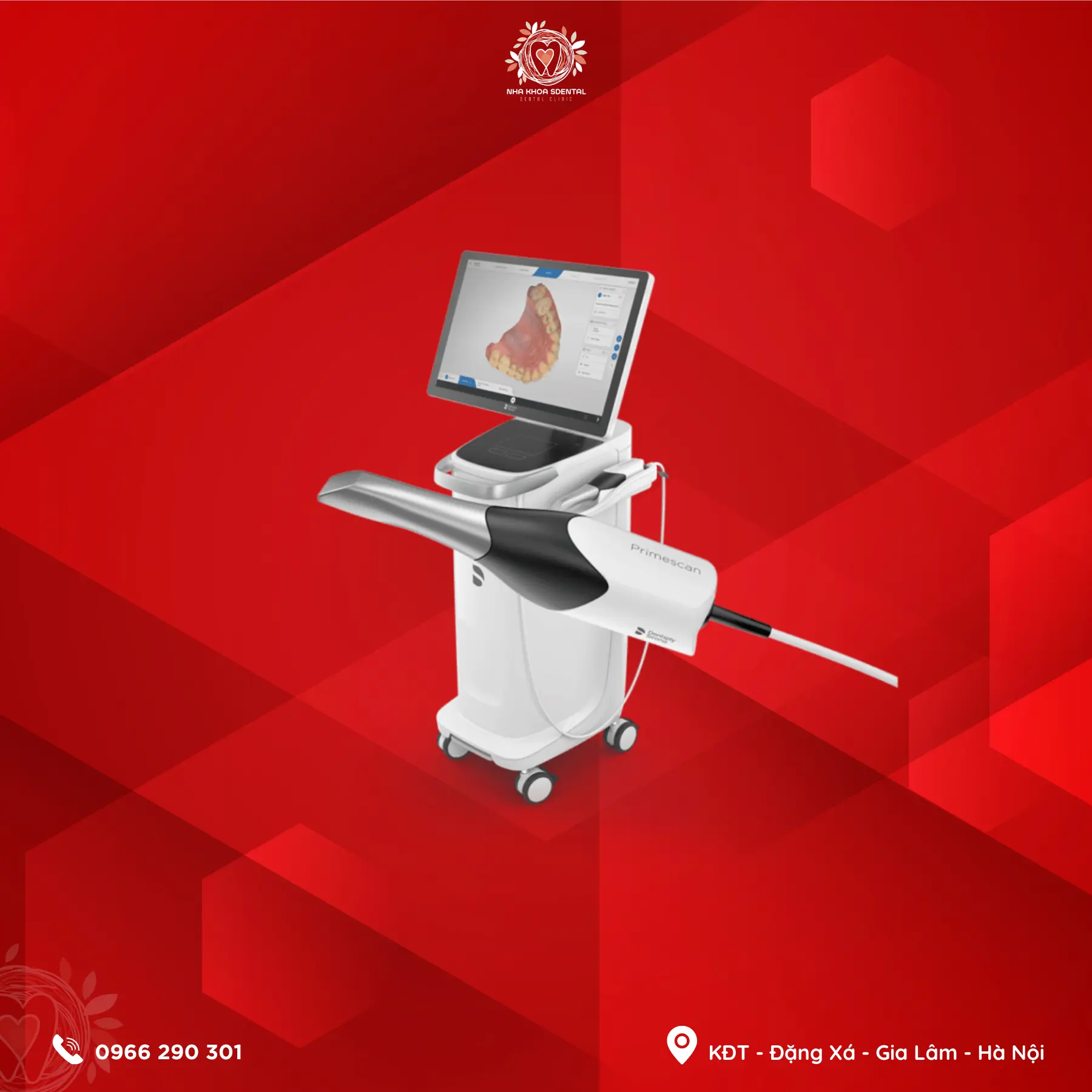 Intraoral Scanner Intraoral Scanner