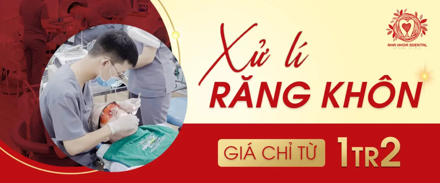 https://sdental.vn/storage/banner-sdental-1536x640jpg.webp