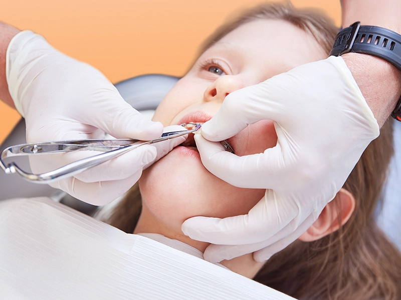Nha khoa niềng răng cho bé Nha khoa niềng răng cho bé