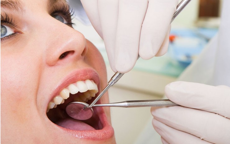Nhổ Răng Số 8 Hàm Trên: Khi Nào Cần, Quy Trình, Biến Chứng, Chăm Sóc và Chi Phí
