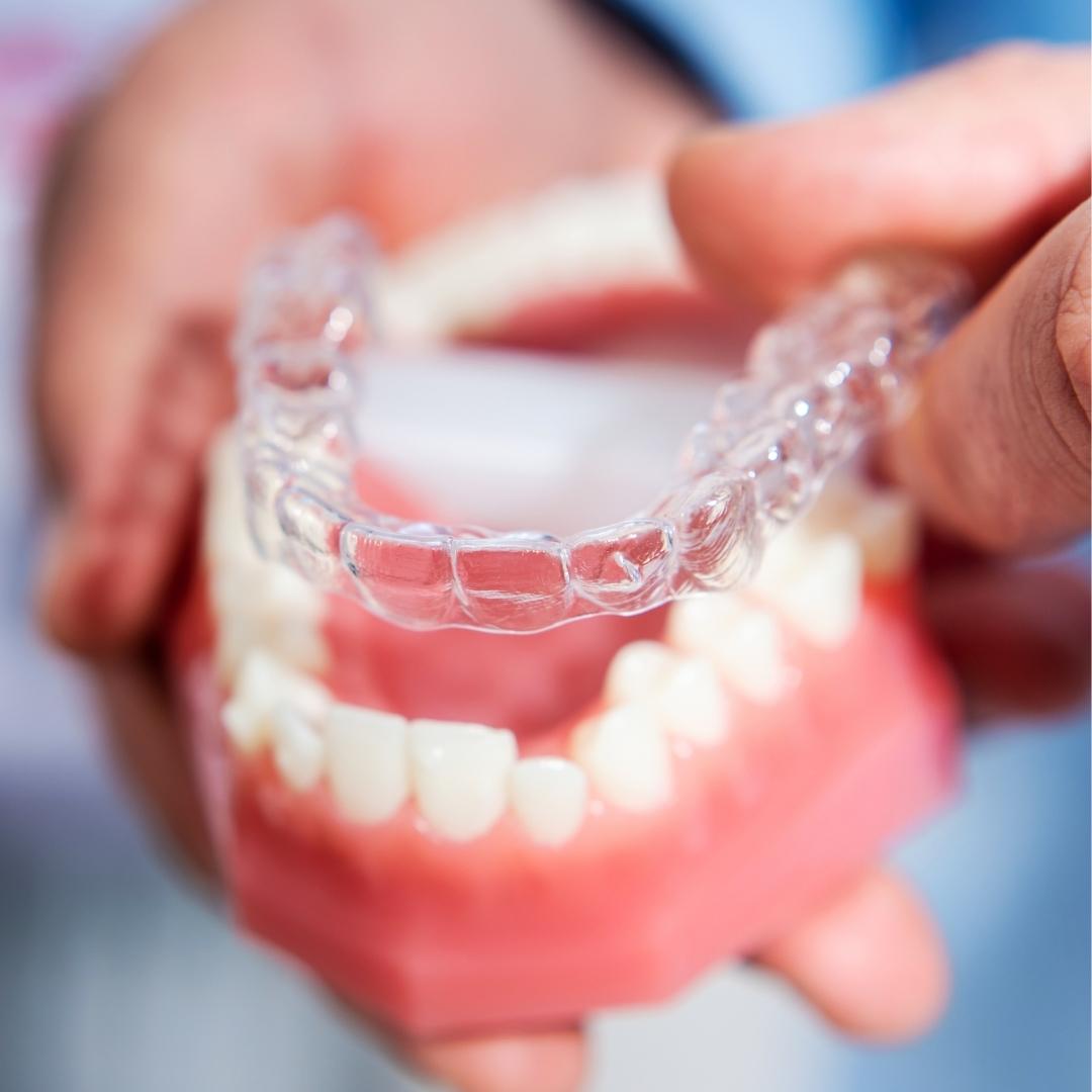 nieng-rang-invisalign-1-1 nieng-rang-invisalign-1-1