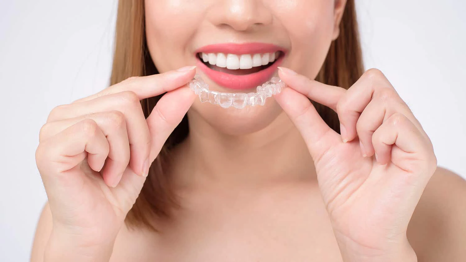 nieng-rang-invisalign-3 nieng-rang-invisalign-3