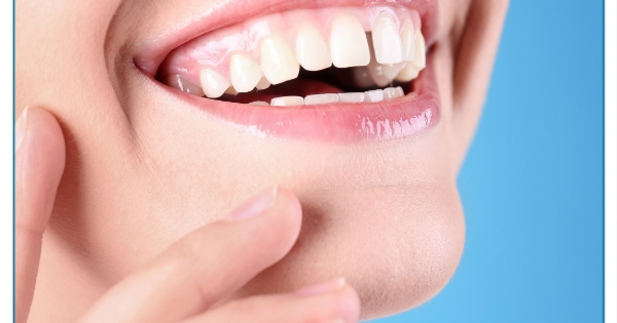 Niềng Răng Thưa Ở Gia Lâm: Giải Pháp Cho Nụ Cười Khít Đều Tự Tin