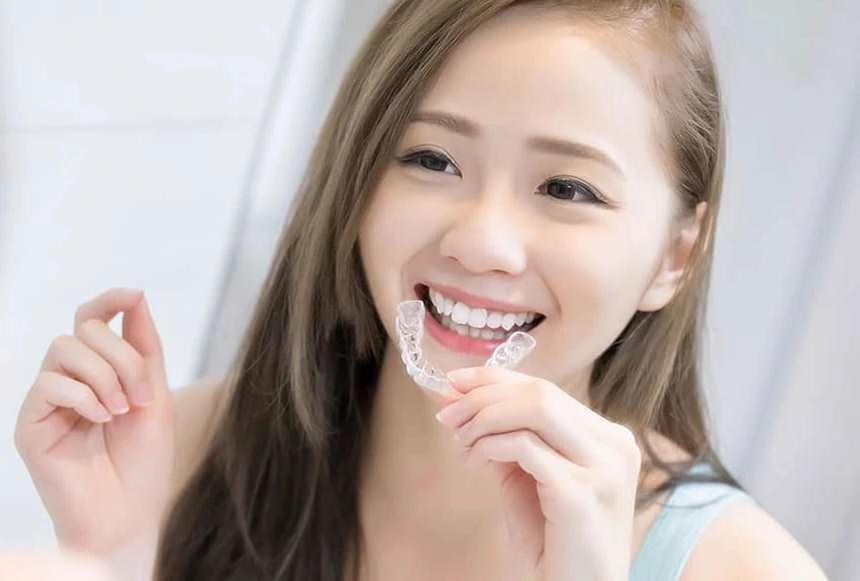 Niềng răng trong suốt clear aligner 1 Niềng răng trong suốt clear aligner 1