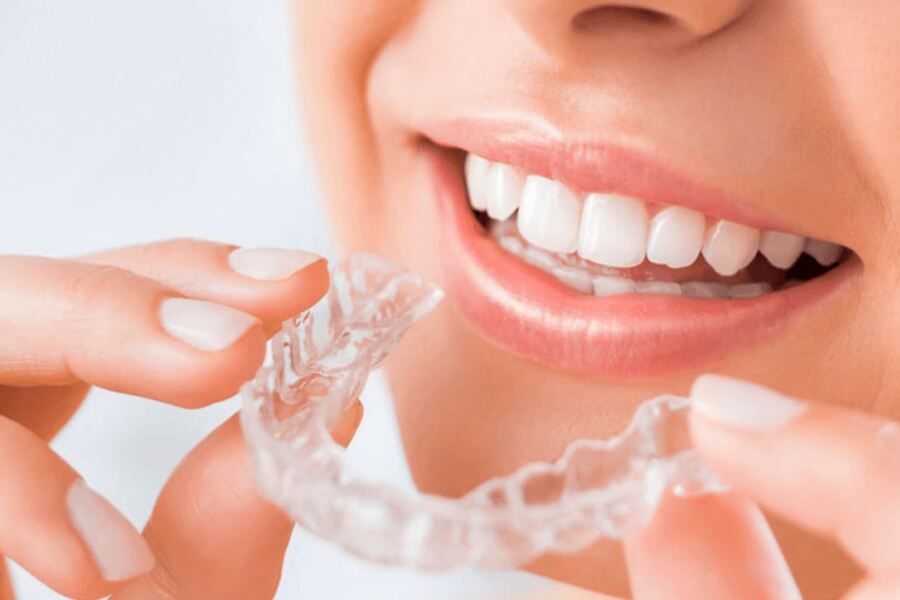 Phí Niềng Răng Trong Suốt Clear Aligner Ở Gia Lâm: Chi Tiết và Cân Nhắc
