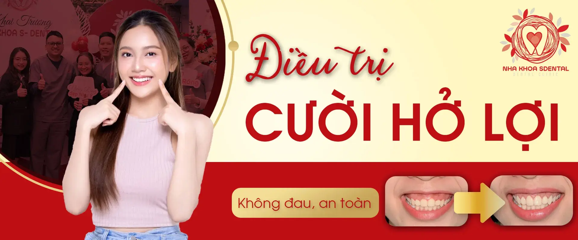 https://sdental.vn/storage/dieu-tri-ho-loijpg.webp