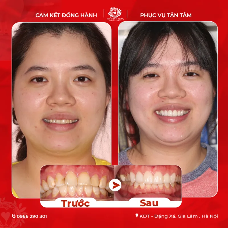 1-5-800x800.png 1-5-800x800.png