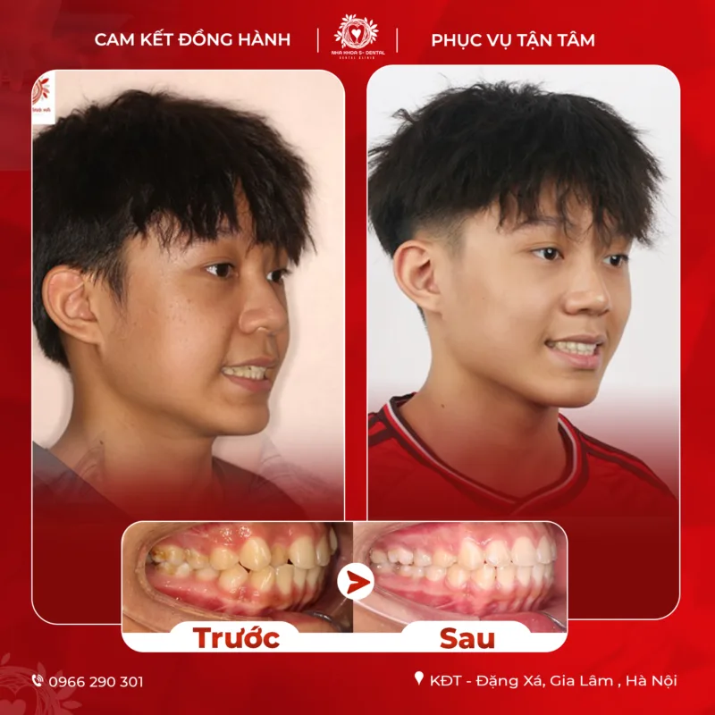2-6-800x800.png 2-6-800x800.png