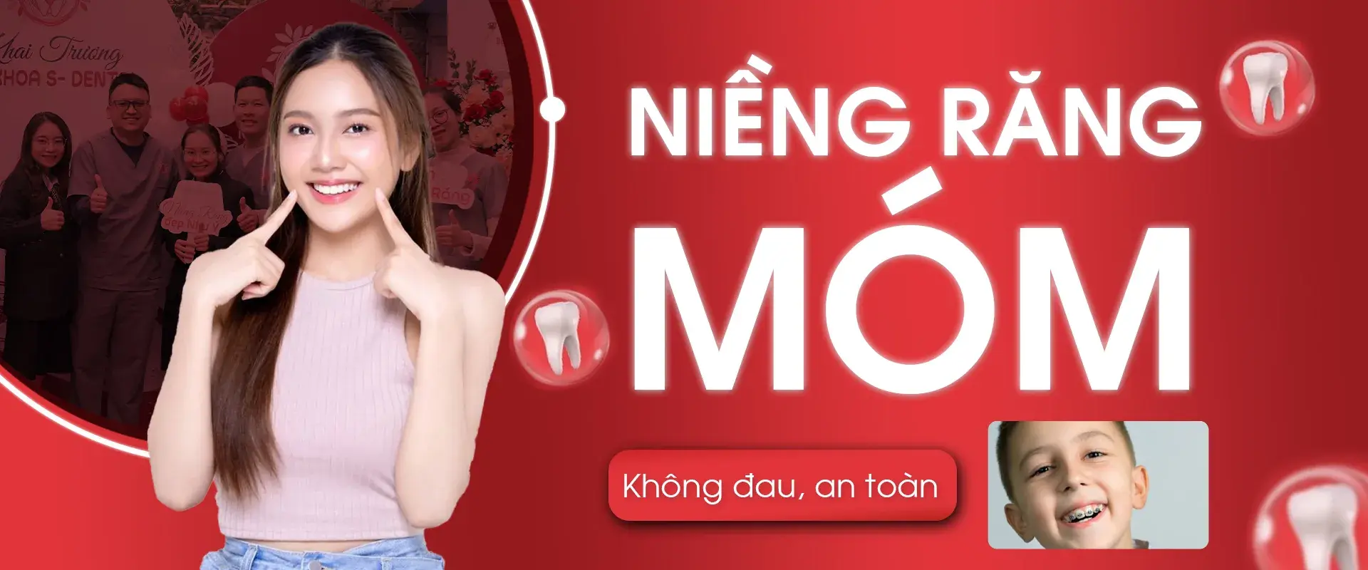https://sdental.vn/storage/nieng-rang-mom-copyjpg.webp