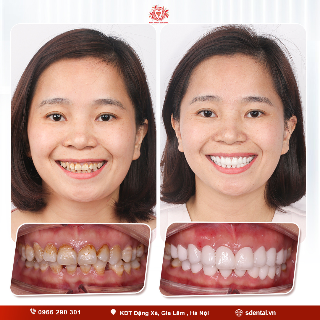 .Hoàng Thị Cầm .Hoàng Thị Cầm