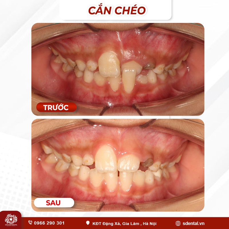can-cheo-02