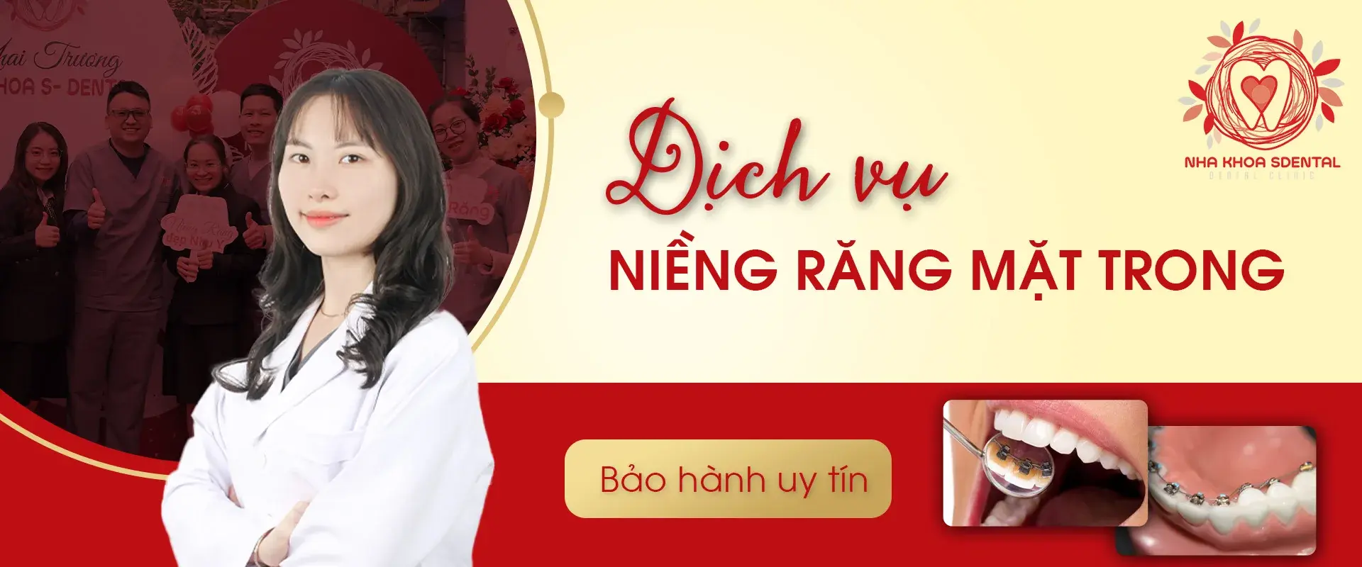 https://sdental.vn/storage/rieng-rang-mat-trongjpg.webp