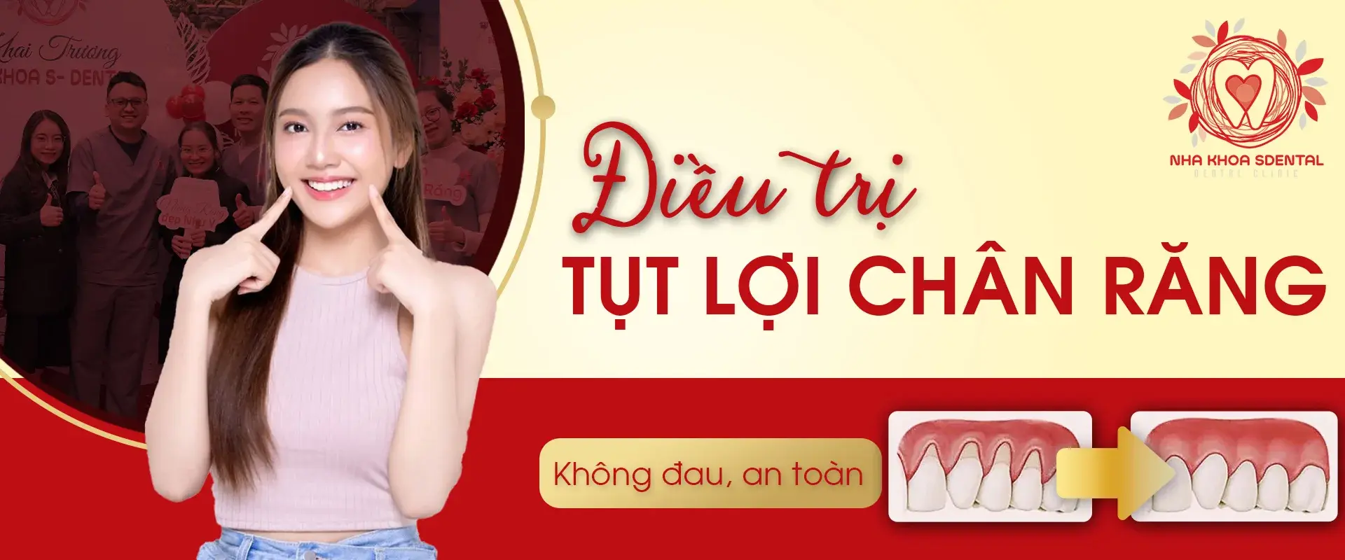 https://sdental.vn/storage/xu-li-ho-loi-copy-1jpg.webp